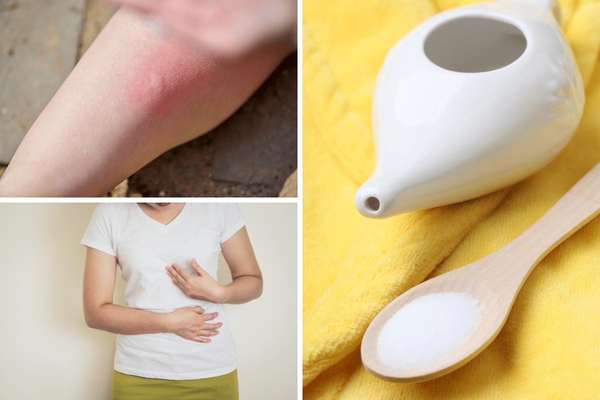 heartburn indigestion neti pot nasal rinse bug bite insect poison ivy itching uses for baking soda