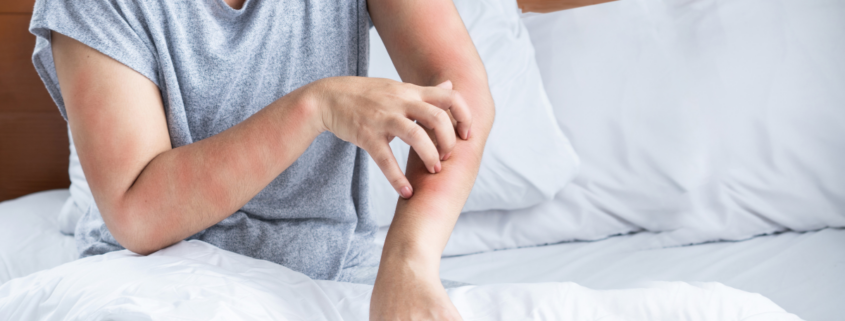 woman have problem with dust mites allergy bedding hand scratching