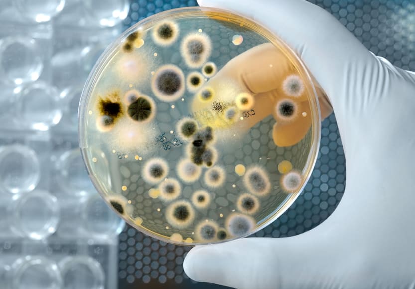 a petri dish with ugly gross bacteria